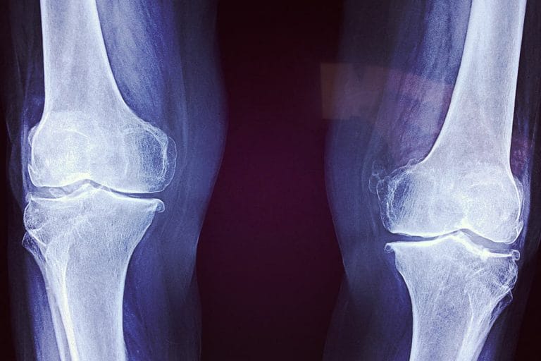 Röntgenbild von Knien